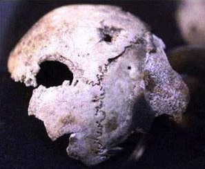 Possibly the skull of Hitler.